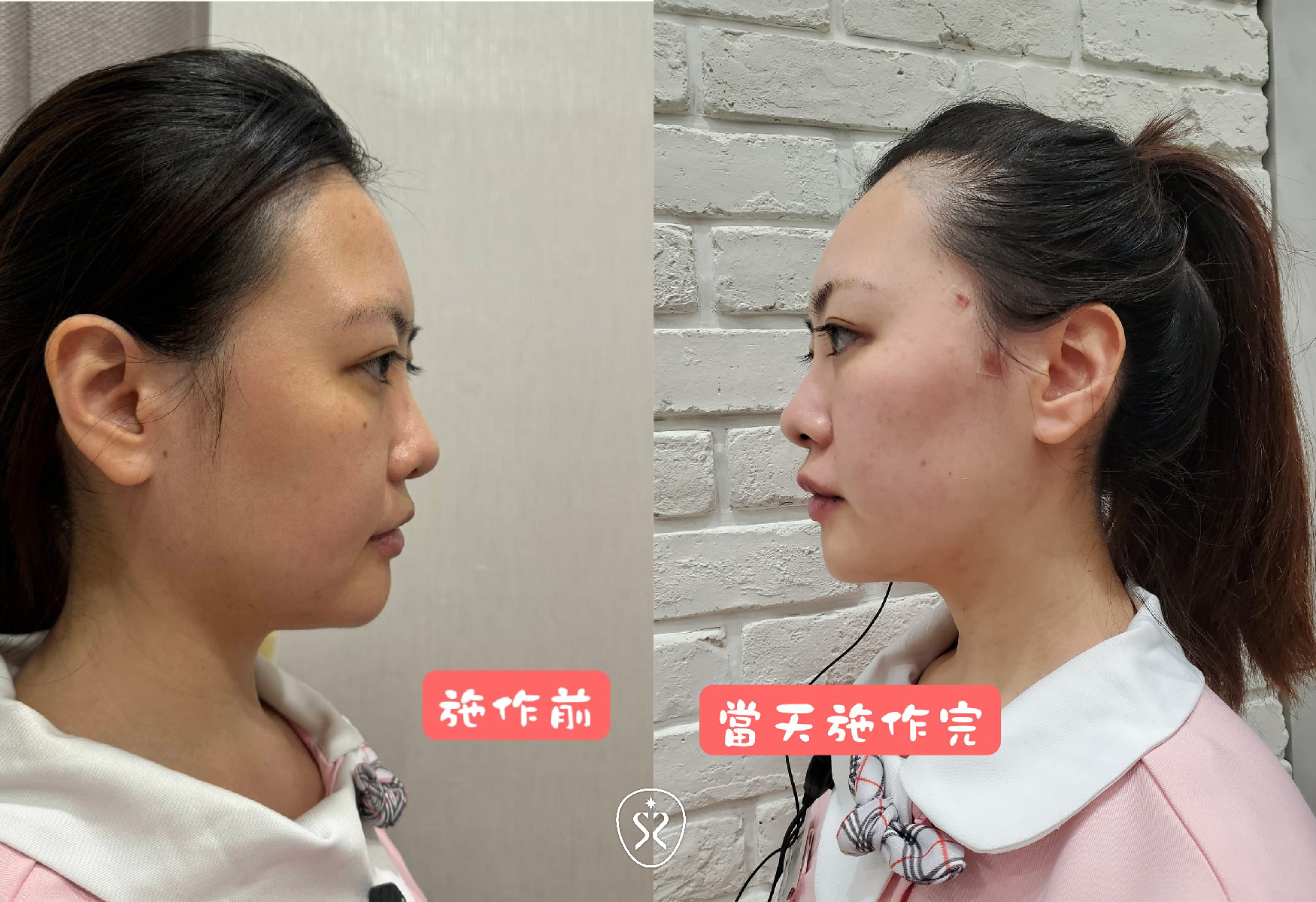 【MINT秘特拉提】